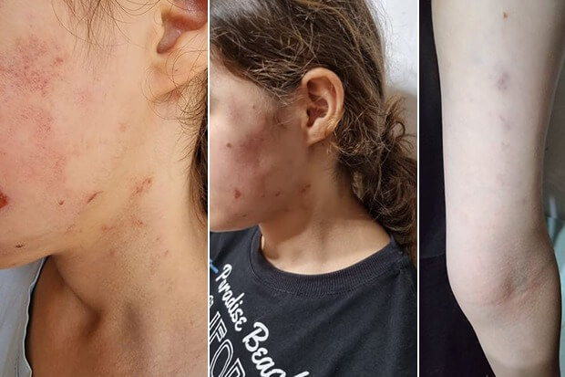 İcra başçısının müavini yeniyetmə qızı vəhşicəsinə döyüb - İDDİA + FOTO