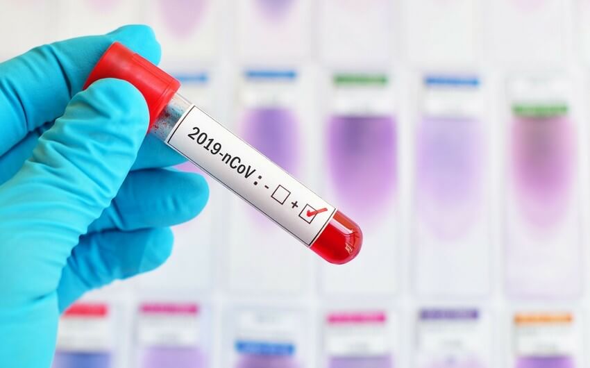 Koronavirusa yoluxanların bu günə olan statistikası