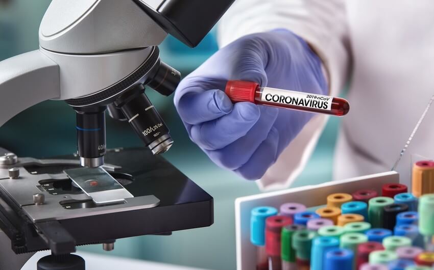 Koronavirusa yoluxanların bu günə olan statistikası