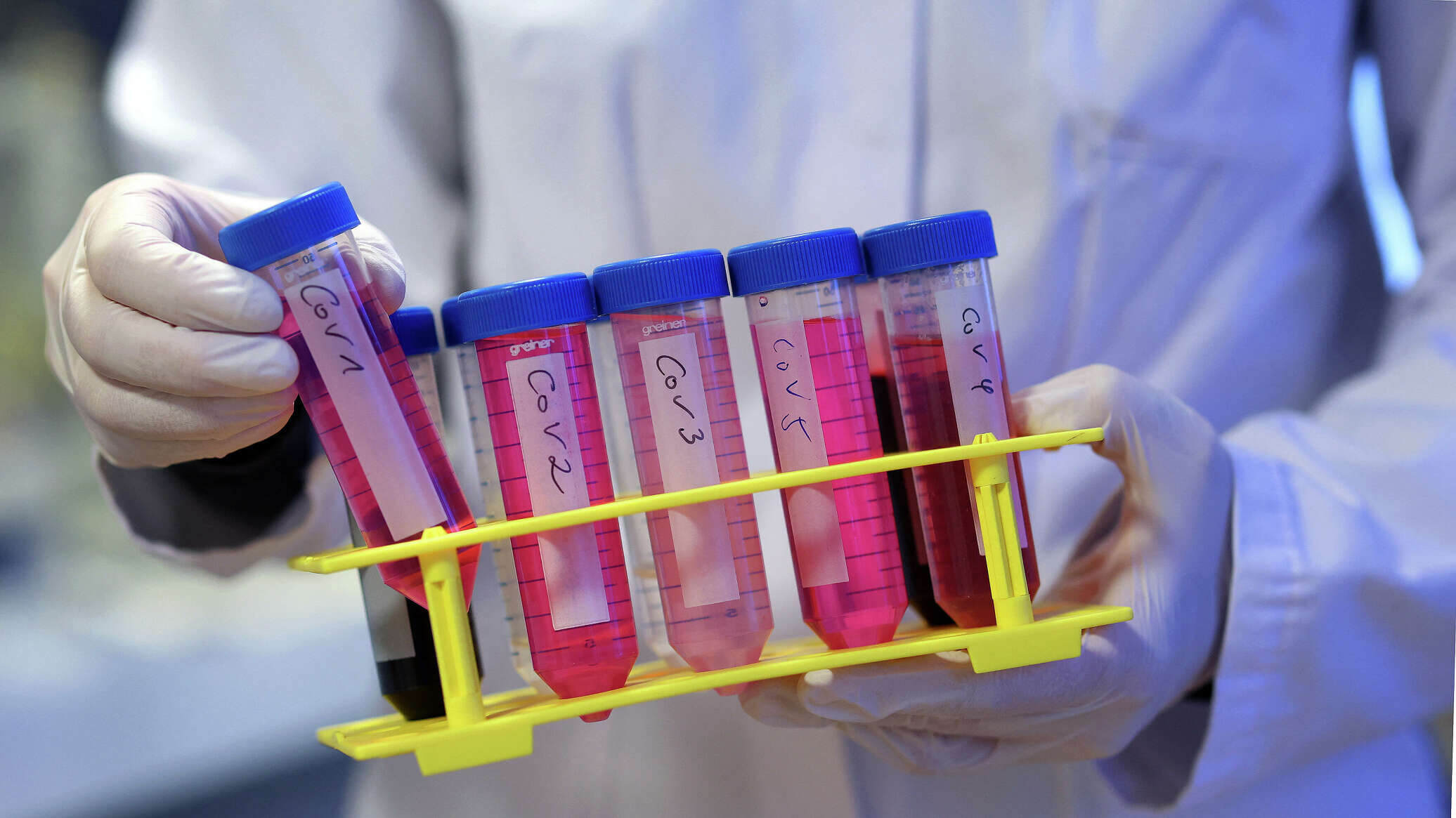 16 nəfər koronavirusa yoluxdu – SON STATİSTİKA