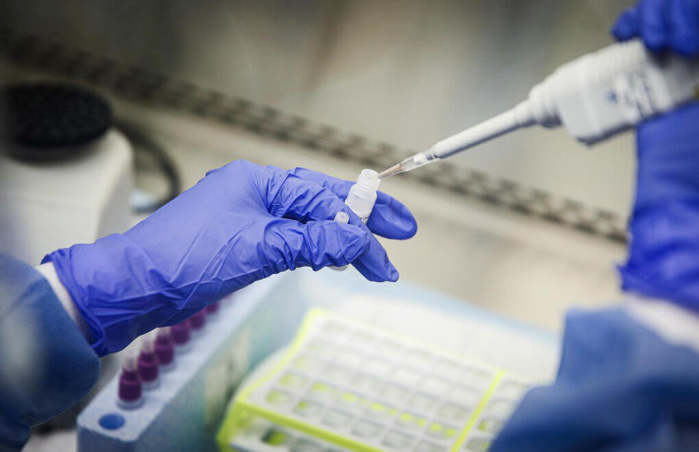 Son sutkadakı yoluxma STATİSTİKASI