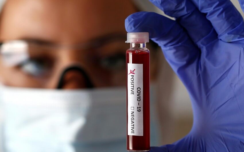 Azərbaycanda COVID-19-un yeni ştamları aşkarlanmayıb