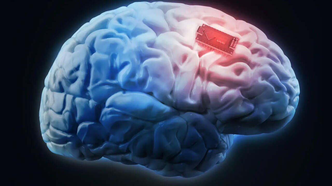 20 ildir danışa bilməyən iflic olmuş qadın süni intellekt sayəsində danışdı