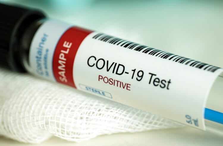 Ölkədə COVİD-19-a yoluxma son bir ayda 18 dəfə artıb